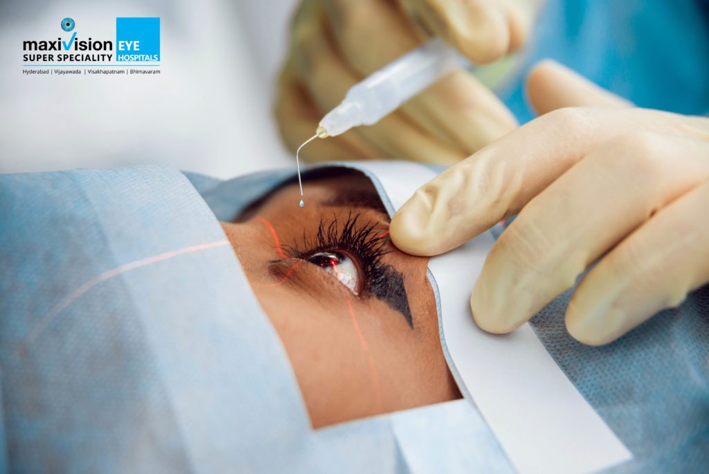 Laser-Assisted Correction