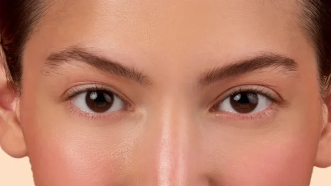 Post-operative care for squint surgery Post-operative care for squint surgery