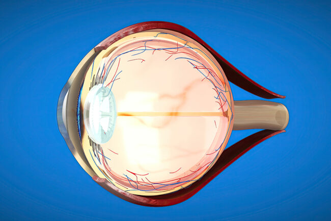retinal detachment treatment