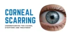 Corneal scarring eye treatment and care