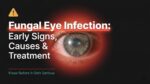 Fungal-Eye-Infection_-Early-Signs,-Causes-and-Treatment