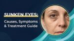 Sunken Eyes Causes, Symptoms and Treatment Guide
