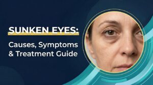 Sunken Eyes Causes, Symptoms and Treatment Guide