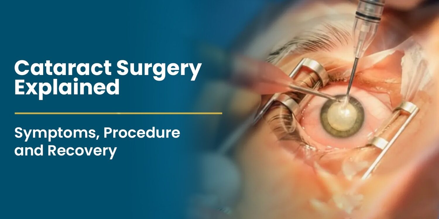 cataract-surgery