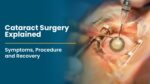 cataract-surgery
