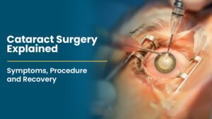 cataract-surgery