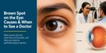 brown-spot-on-eye-causes-symptoms-treatmen