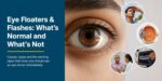 eye-floaters-flashes-causes-types-treatmen