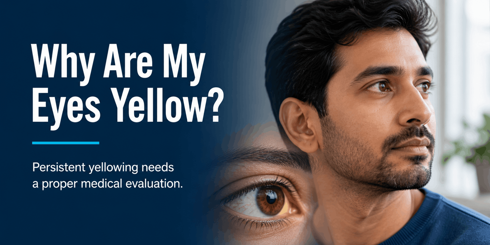 maxivision-yellow-eyes-banner-template