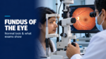 fundus of the eye examination guide